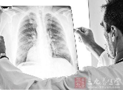 肺部CT检查结果却意外发现肾脏疾病