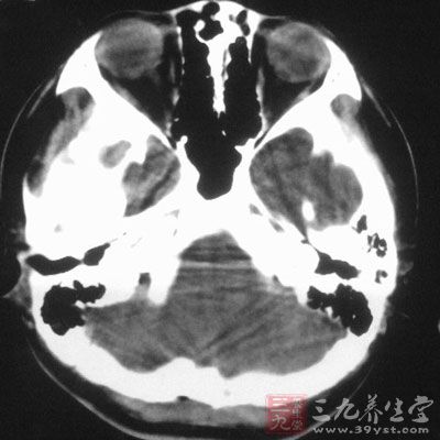 一场学术盛宴 北京国际痴呆研讨会成功召开