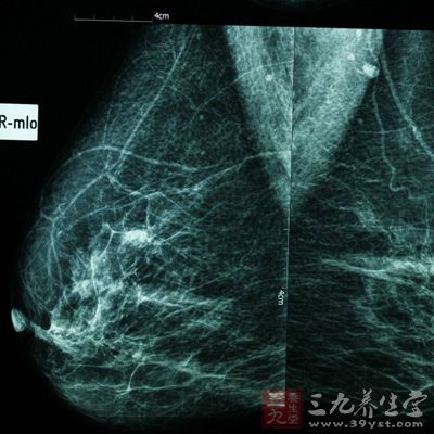 临床摸不到肿块是靠影像学检查发现可疑病变，可借助影像学检查定位进行活检