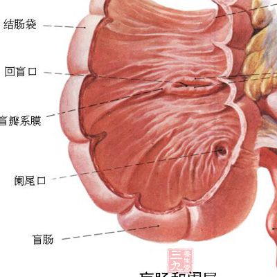 急性阑尾炎临床表现有哪些