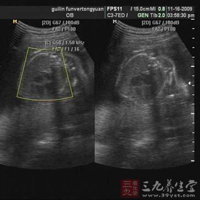 超声诊断过程相比,可以实时的观察人体内部器官的动态运动