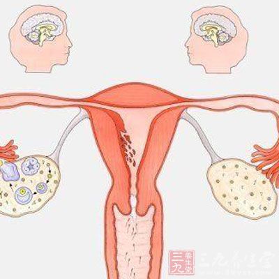 如果是由于內(nèi)分泌功能低下、腫瘤、子宮發(fā)育不全等疾病，導(dǎo)致月經(jīng)量過少，甚至閉經(jīng)，那么不孕的幾率則會大大增加