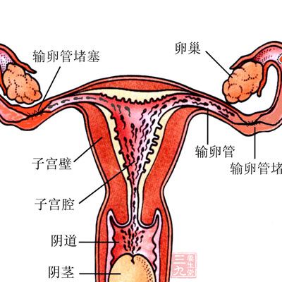 此時性交,男性生殖器會把細菌帶入,感染子宮內(nèi)膜導(dǎo)致盆腔炎癥,給女方帶來痛苦