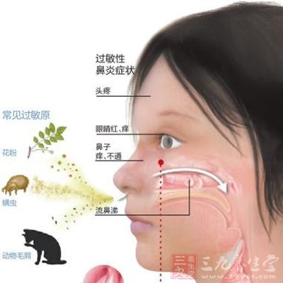 过敏性鼻炎不易治 容易升级变哮喘(2) - 三九养生堂