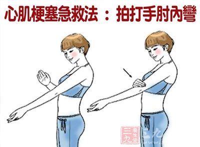 突发心肌梗塞的急救方法有哪些