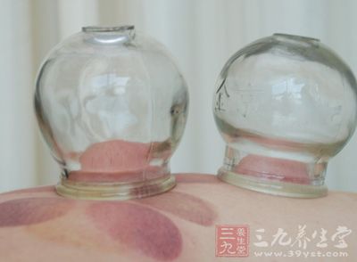 拔罐减肥拔罐真的能够减肥吗