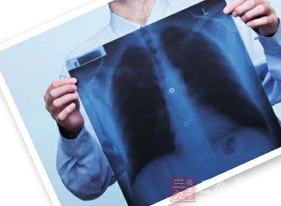 又到体检季 肺部小结节高发