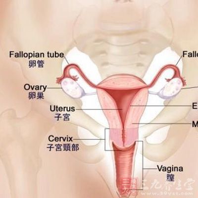 急性盆腔腹膜炎，盆腔内器官发生严重感染时，往往蔓延到盆腔腹膜，发炎的腹膜充血、水肿，并有少量含纤维素的渗出液，形成盆腔脏器粘连