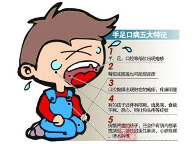 手足口病的初期症状_手足口病的预防措施及传