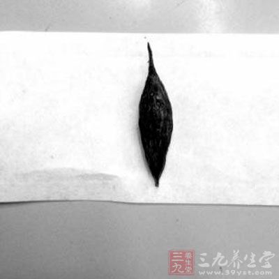 最后是通过内窥镜将这颗枣核取了出来 最后是通过内窥镜将这颗枣核取了出来
