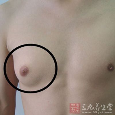 男性乳腺癌症状之一无痛性肿块