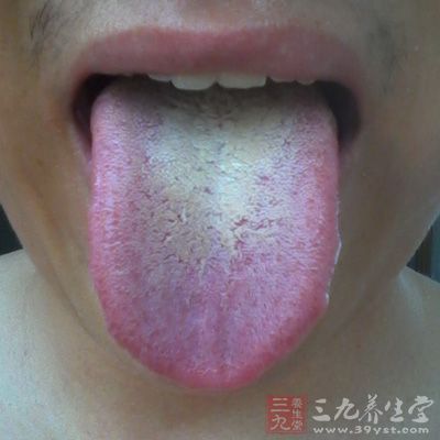 舌苔发黄多见于热性疾病中