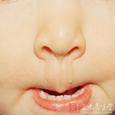 小儿咳嗽有痰怎么办 咳嗽的治疗方法(2)