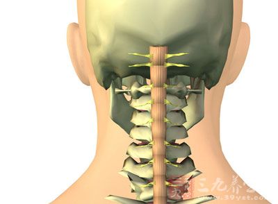 颈部有不同程度的僵硬或痛性斜颈畸形、肌肉紧张、活动受限