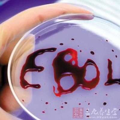 埃博拉病毒(Ebola)近來(lái)讓全球陷于恐慌之中