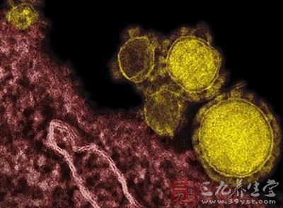 目前还没有针对性的治疗方式，也还没有疫苗，主要就是支持治疗