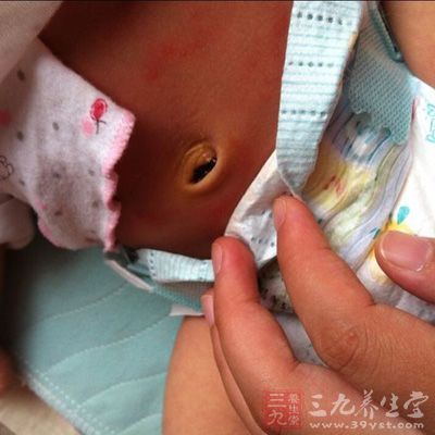 肚脐眼流水 新生儿肚脐眼流水怎么办
