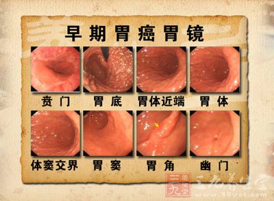 第四军医大nature子刊胃癌新成果