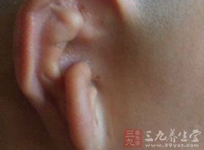 如果耳后是一片儿小的红疙瘩,多半是过敏.