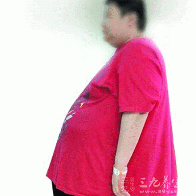 428斤肥仔 缩胃"求瘦"