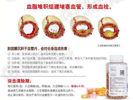 血脂堆积组建堵塞血管，形成血栓