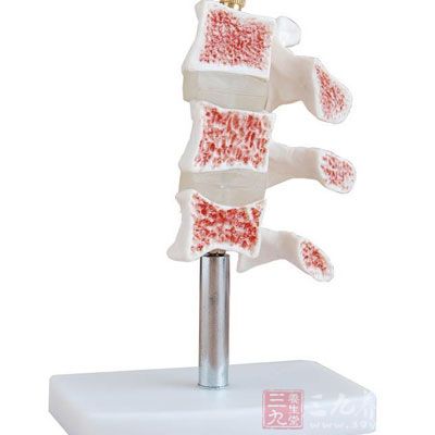 研究发现酒精可影响骨密度及新骨的形成