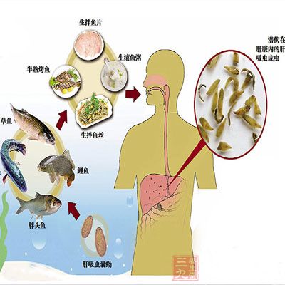 医生推测,小静可能吃了没有煮熟的猪肉,也可能误食被带有猪肉绦虫粪便