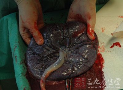 美国新研究显示 食用胎盘对健康没好处