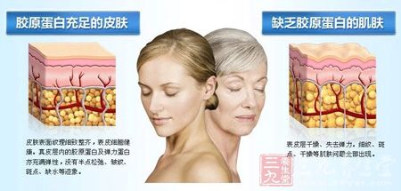 缺乏胶原蛋白的肌肤 缺乏胶原蛋白的肌肤