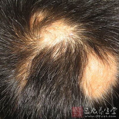 对镜看看毛发 是否有病只要一眼 - 三九养生堂