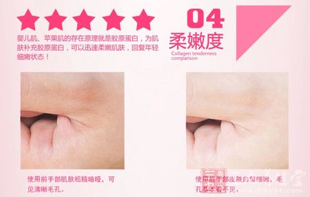 婴儿肌、苹果肌的存在原理就是胶原蛋白