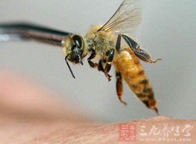 壮汉遭蜂蜇不以为然 怎料致全身过敏险丧命