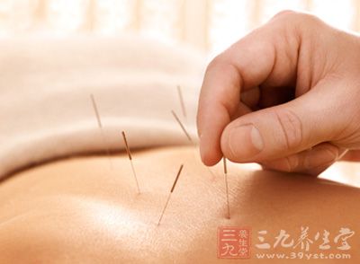 按摩针灸 按摩针灸的好处都有哪些