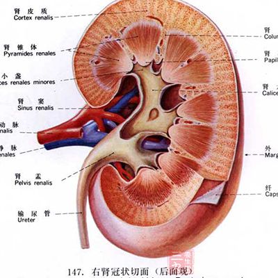 腎結(jié)石是泌尿系統(tǒng)的常見(jiàn)疾病之一