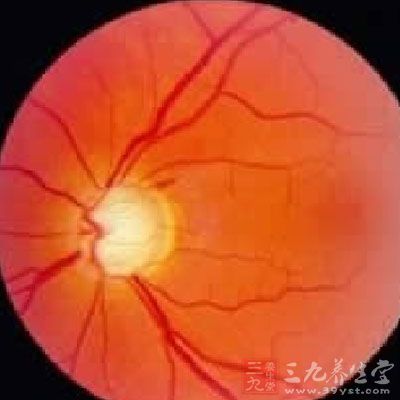 成人近视突然加深 原是糖尿病惹的祸