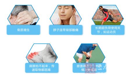 长期超负荷使用关节,如运动员 长期超负荷使用关节,如运动员