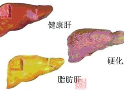 肝脏是我们身体里很重要的消化器官