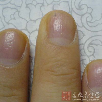 中医望诊 中医如何看面相知健康(9)