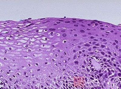 女性的第 一大杀手竟是它