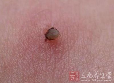 拔了这处的黑痣竟有致命风险