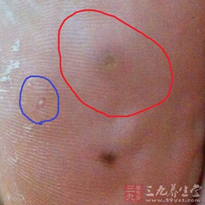 男人哪里痣注定会出轨(2)