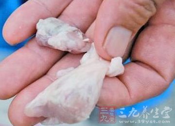 如果吃了被污染的牛羊肉,是有可能感染上"肝包虫病"的