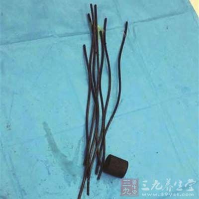 男子被7根钢筋穿身 插进16根管子整天冲洗获救