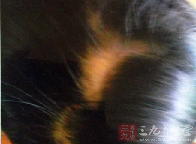 <em>3岁</em>女童<em>幼儿</em>园内7天2次受伤 <em>头发</em>被扯掉 - 三九