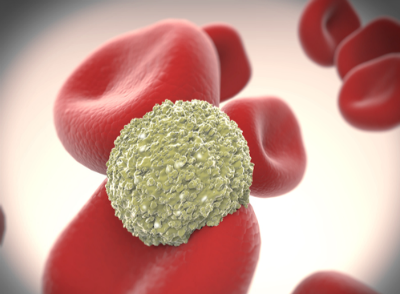Nature Medicine免疫疗法带来治愈血癌新希望