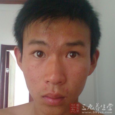 怎样美白祛斑 男士皮肤变好秘笈(10)