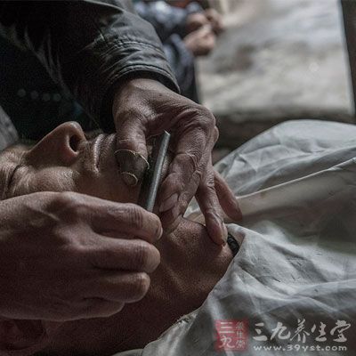 杭州减少乙肝患者10万余人(2)