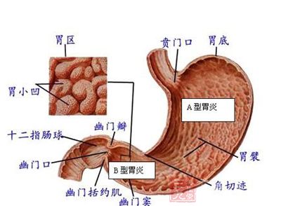 肠胃炎吃什么药 如何治好肠胃炎