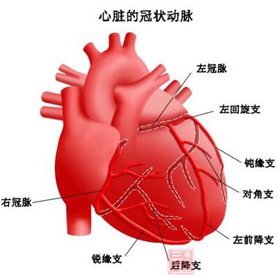 心肌缺血的介入治疗