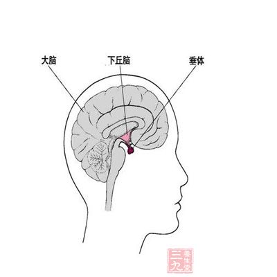 垂体瘤症状 垂体瘤该如何治疗及预防(3)